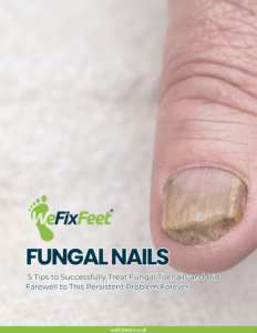Fungal Nails - 5 Tips to Successfully Treat Fungal Toenails and Bid Farewell to This Persistent Problem Forever