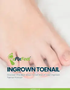 Ingrown Toenail - Discover The Best Ways To Get Rid Of Your Ingrown Toenail Forever